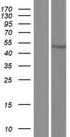 Sohlh2 (CCDC169-SOHLH2) Human Over-expression Lysate