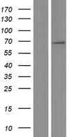 TCF7L2 Human Over-expression Lysate