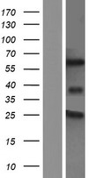 TCF7L2 Human Over-expression Lysate