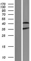 Aprataxin (APTX) Human Over-expression Lysate
