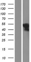 Wilms Tumor Protein (WT1) Human Over-expression Lysate