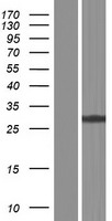 glutathione S transferase Omega 1 (GSTO1) Human Over-expression Lysate