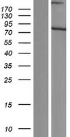 SCMH1 Human Over-expression Lysate
