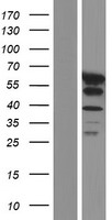 UBAP1 Human Over-expression Lysate