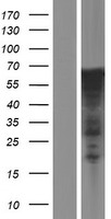 FKLF / KLF11 (KLF11) Human Over-expression Lysate