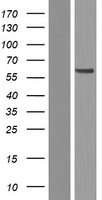 RAI2 Human Over-expression Lysate