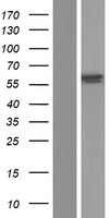 Iduronate 2 sulfatase (IDS) Human Over-expression Lysate