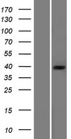 PDHB Human Over-expression Lysate