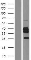 CYB5R3 Human Over-expression Lysate