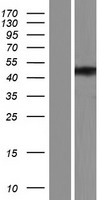 ZFYVE27 Human Over-expression Lysate