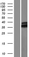 MYD88 Human Over-expression Lysate