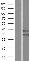 RHBDD1 Human Over-expression Lysate
