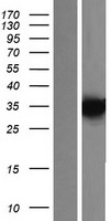 KCTD7 Human Over-expression Lysate