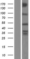ZFYVE27 Human Over-expression Lysate