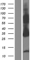 ASB9 Human Over-expression Lysate