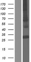 Adiponectin (ADIPOQ) Human Over-expression Lysate