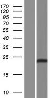 Claudin 2 (CLDN2) Human Over-expression Lysate