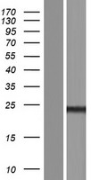 CT45A5 Human Over-expression Lysate