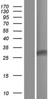 DMAC2 Human Over-expression Lysate
