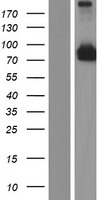 ODAD1 Human Over-expression Lysate