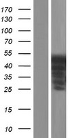 ER81 (ETV1) Human Over-expression Lysate