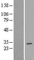 YIF1B Human Over-expression Lysate