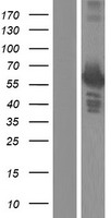 PFKFB3 Human Over-expression Lysate