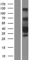 TMEM25 Human Over-expression Lysate