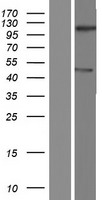 NEMP2 Human Over-expression Lysate