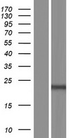 C9orf47 Human Over-expression Lysate