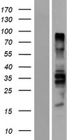 PTPN18 Human Over-expression Lysate