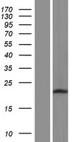 ATPBD4 (DPH6) Human Over-expression Lysate