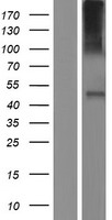 BIGM103 (SLC39A8) Human Over-expression Lysate