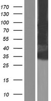 KCNK16 Human Over-expression Lysate