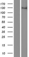 AREB6 (ZEB1) Human Over-expression Lysate