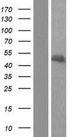ACADM Human Over-expression Lysate