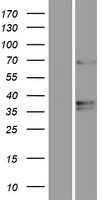 TMEM87A Human Over-expression Lysate