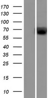UGT2A2 Human Over-expression Lysate