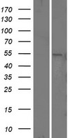 Presenilin 1 (PSEN1) Human Over-expression Lysate