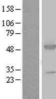 ASS1 Human Over-expression Lysate