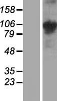 COMP Human Over-expression Lysate