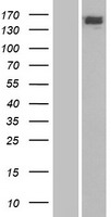 CSB (ERCC6) Human Over-expression Lysate