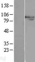 XPB (ERCC3) Human Over-expression Lysate