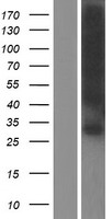 GJB1 Human Over-expression Lysate