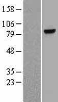 Myeloperoxidase (MPO) Human Over-expression Lysate