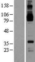 IL4R Human Over-expression Lysate