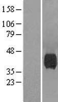 Neuraminidase (NEU1) Human Over-expression Lysate