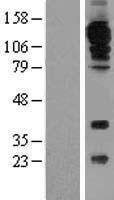 CD31 (PECAM1) Human Over-expression Lysate