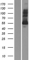 Glutathione Reductase (GSR) Human Over-expression Lysate