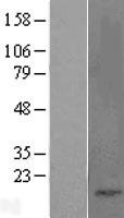 Cholecystokinin (CCK) Human Over-expression Lysate